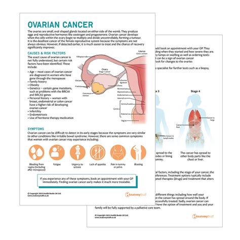biopsy for ovarian cyst|Patient education: Ovarian cancer diagnosis and staging.